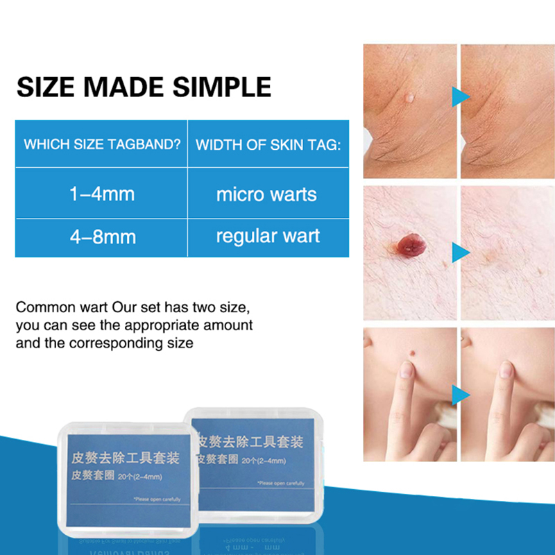 20pcs/Box Flesh Nevus Removal  - Men Accessories Kit 评论和价格